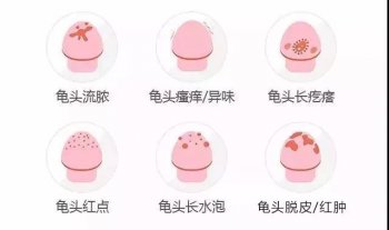 阴茎痛、痒、红肿、长疙瘩