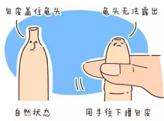 包皮出现溃烂怎么办
