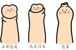 男人为什么会包皮过长